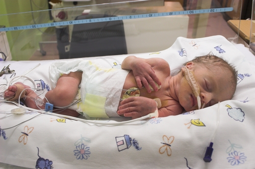 a phthalate in medical equipment may be harmful for premature babies 1646 40013904 0 14032137 500 - Medical equipment may expose premature babies to phthalate