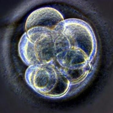 bpa may negatively impact the development of heart valves 1646 40004916 0 6001378 369 - BPA may impact developing heart valves